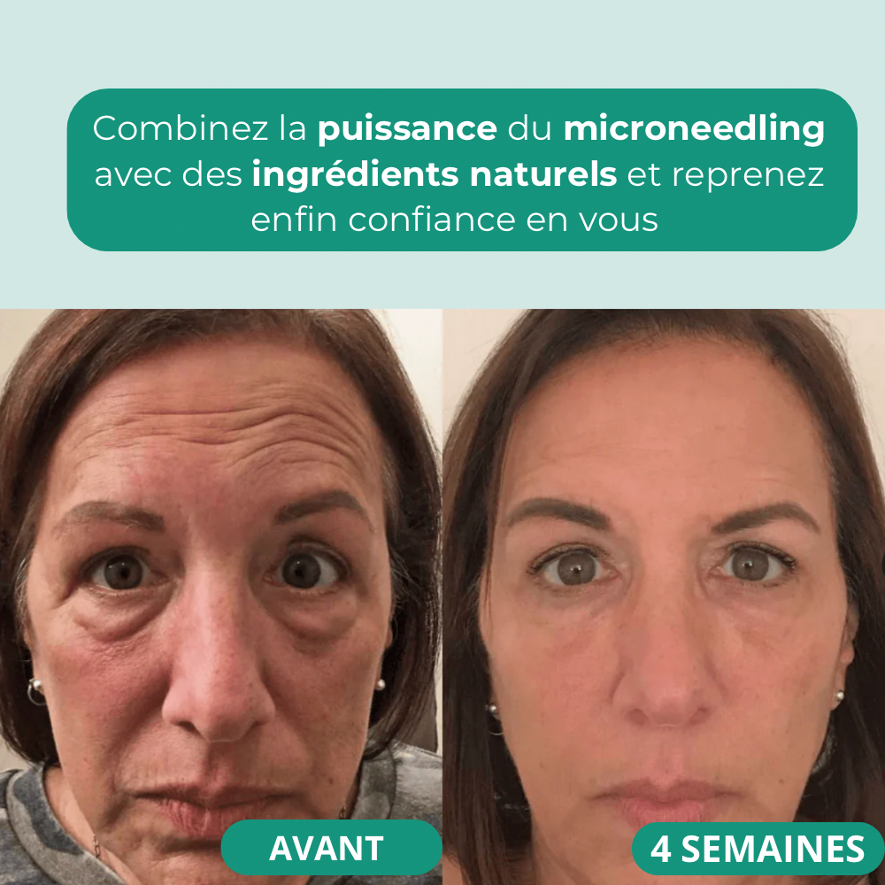 Patch Lift Pro - Anti cernes et Poches